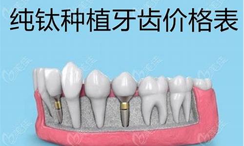 牙齿钛合金价格表_钛合金牙齿寿命